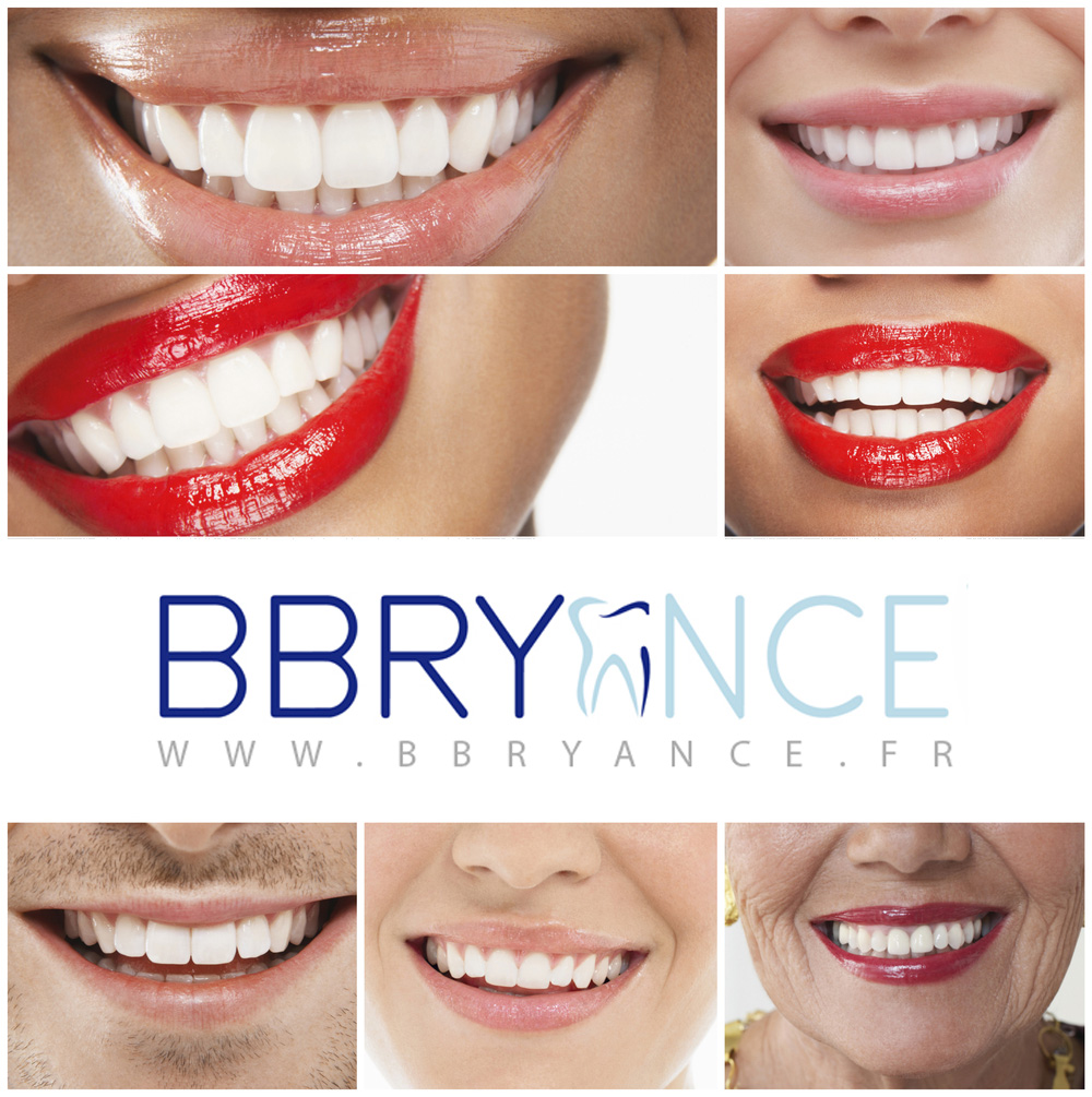 Blog – Kit Blanchiment Dentaire BBRYANCE ©